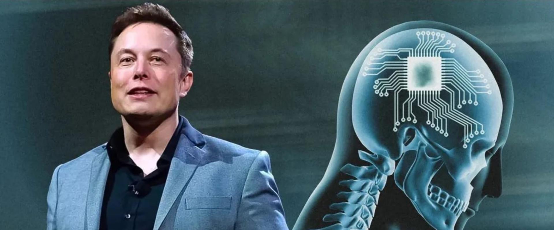 Probléma lépett fel Elon Musk első emberi agyba ültetett Neuralinkjével