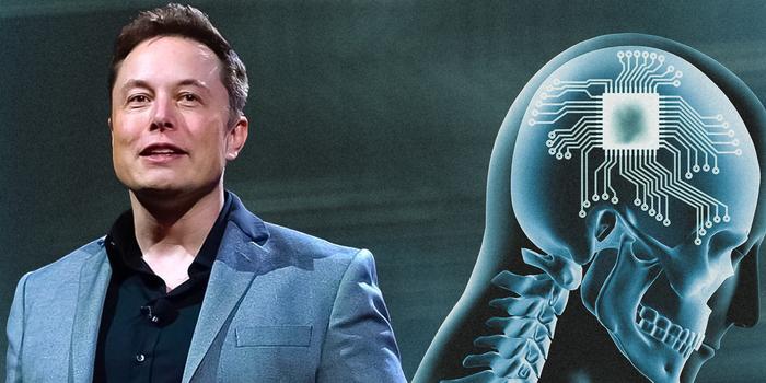 Gaming - Mérföldkő: Elon Musk bejelentette, emberi agyba ültették a Neuralinket
