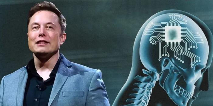 Probléma lépett fel Elon Musk első emberi agyba ültetett Neuralinkjével kép