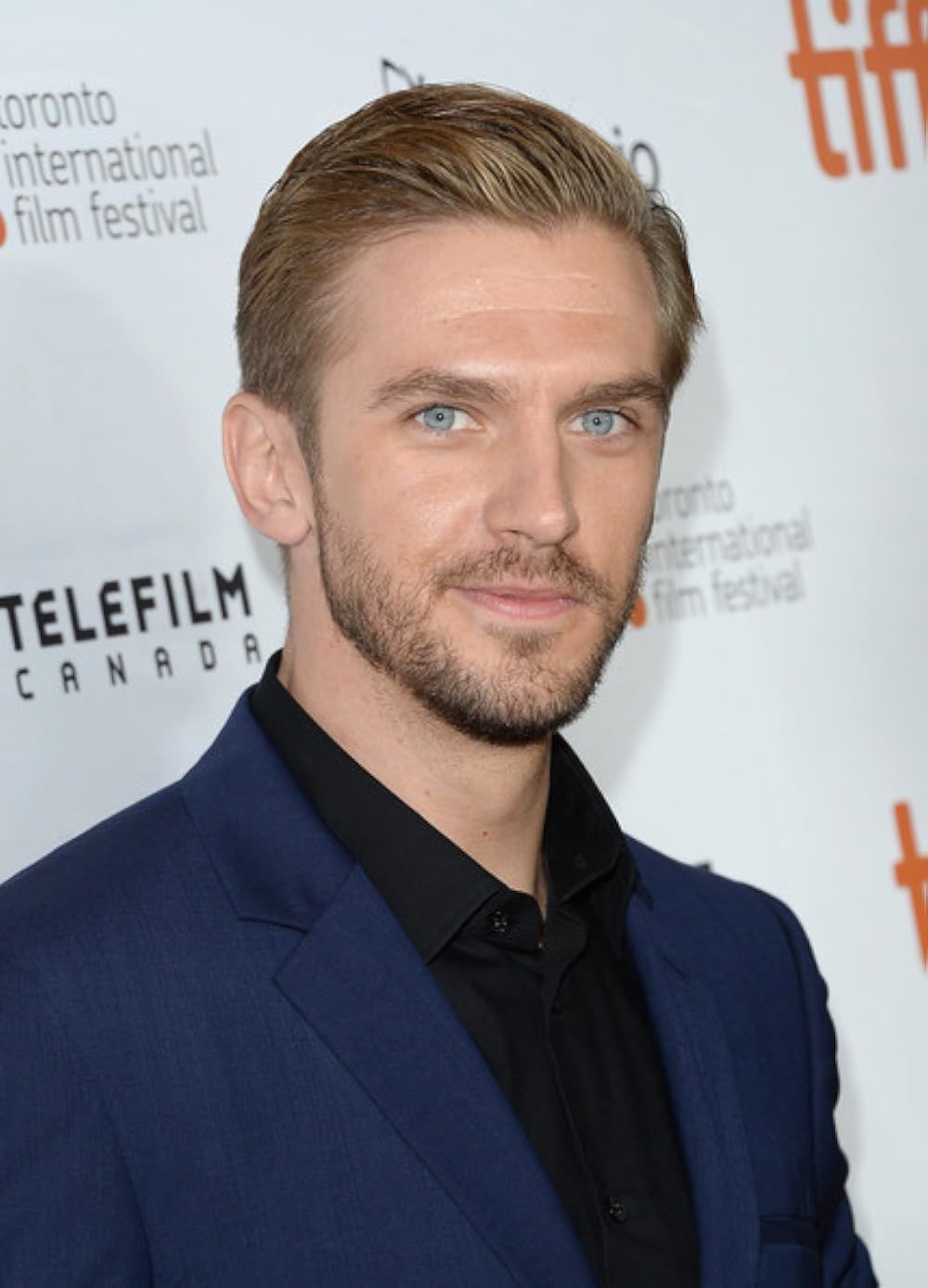 Remus Lupin: Dan Stevens (Legion, Beauty and the Beast)